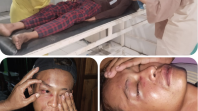 Dugaan Penganiayaan di Desa Perugayan: Remaja 17 Tahun Dipukul Berulang Kali, Pelaku Belum Dikonfirmasi
